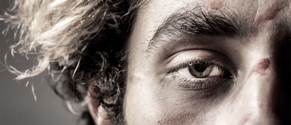 A close-up of the corner of a man’s face, his eye staring out. There is blood on his face.